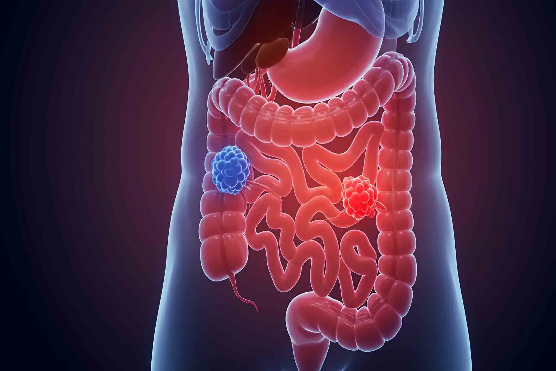 大腸