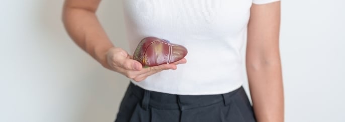 手持肝臟模型，示意肝臟感染及甲型肝炎相關情況。