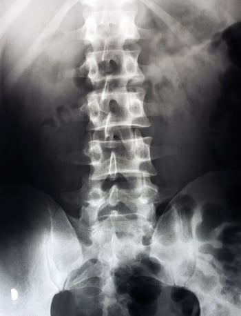spine