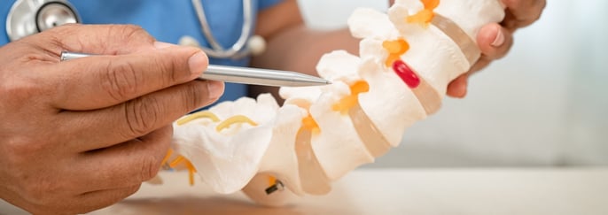 Doctor with lumbar vertebra bone skeleton and nerve model Doctor with lumbar vertebra bone skeleton and nerve model