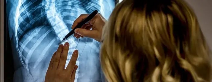 Scoliosis specialist Doctor with patients X-Ray