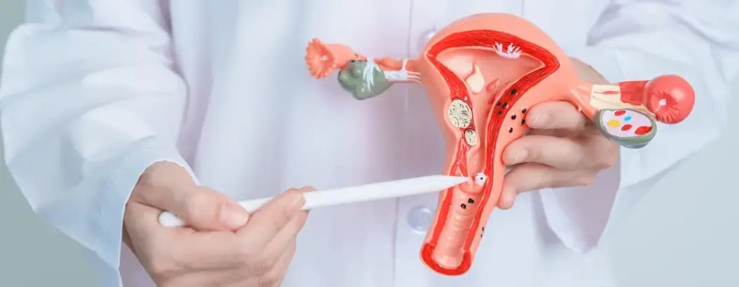 子宮模型近鏡，用作講解子宮結構及婦科狀況。