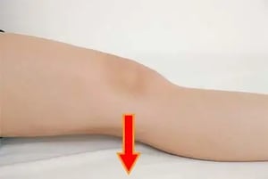 示範靜態股四頭肌運動，進行腿部肌肉強化作為復康訓練的一部分。