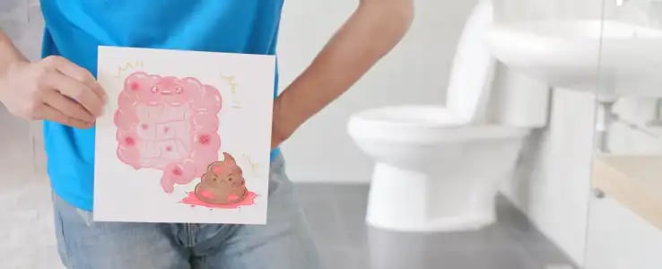 rectal-3