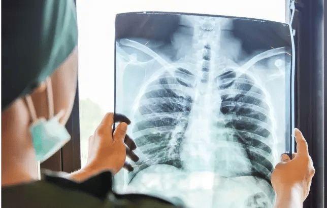 doctor_examining_xray