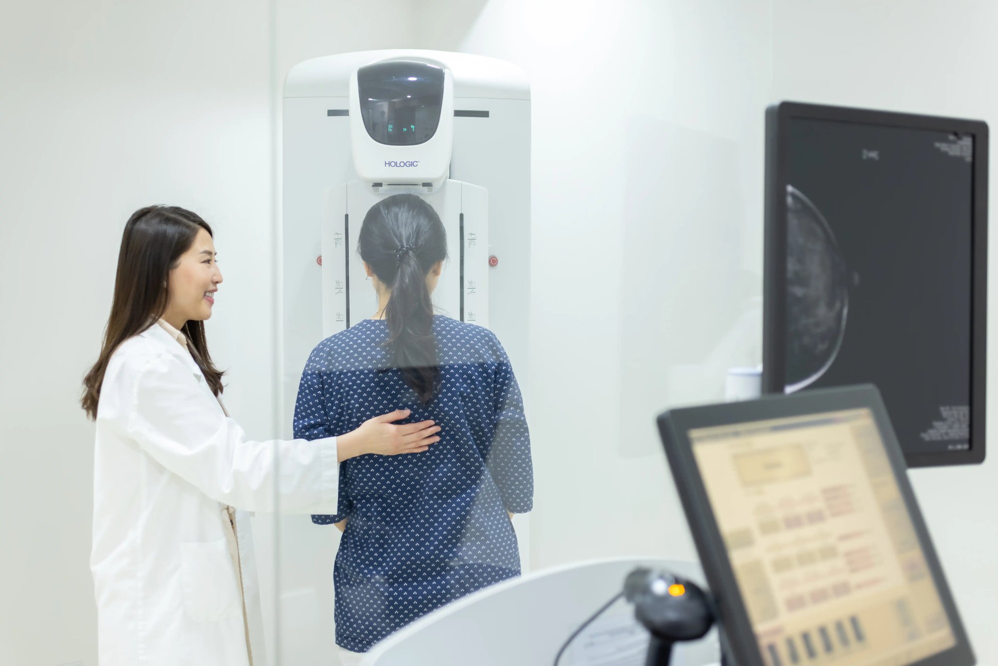 mammogram