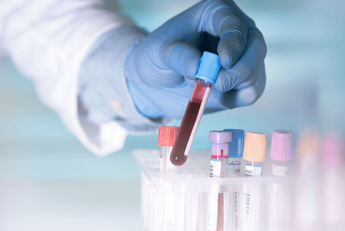 img-laboratory-test-tubes