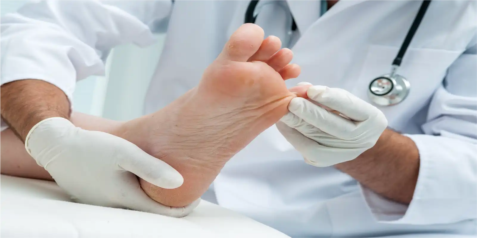 Foot fungus