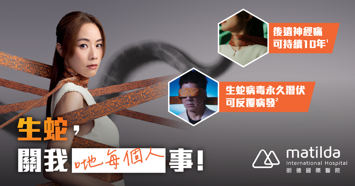 預防生蛇 預防生蛇